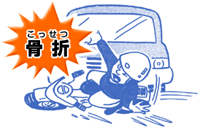 骨折（こっせつ）